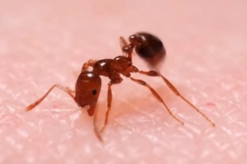 Fire Ant on skin